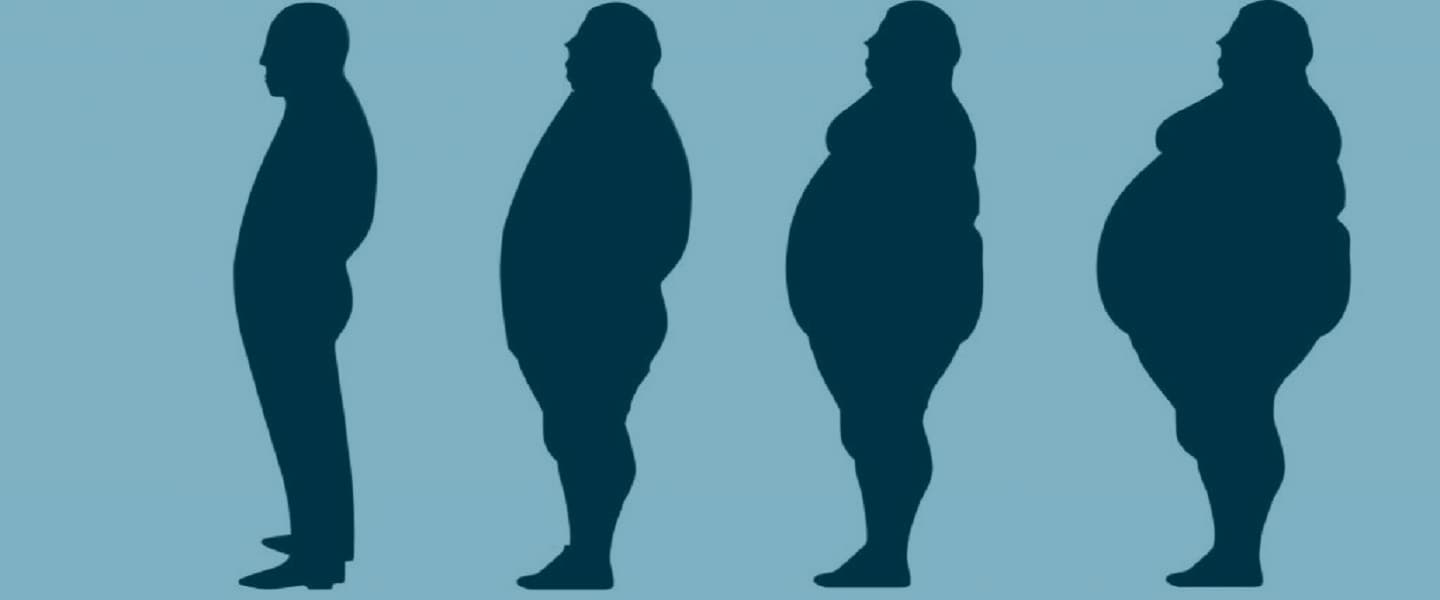 Гипоталамическое ожирение